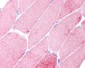 ACTA1 / ASMA Antibody (clone 3B3)